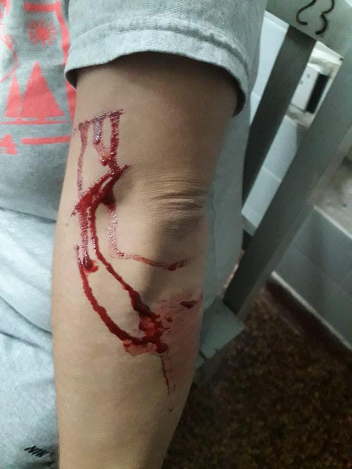 Detuvieron en Alto Verde a una pareja de San Javier con numerosos antecedentes violentos