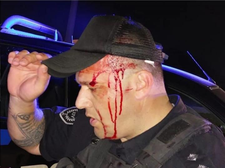 Avellaneda: usurpadores de terrenos agredieron a la policía 
