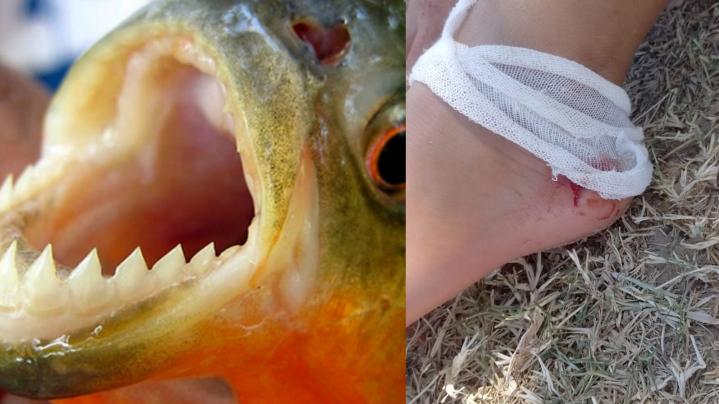 San Javier: las palometas atacaron a varias personas en la playa